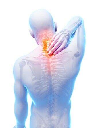 Spinal Osteochondrose, an där den Hondrocream onverzichtbar ass