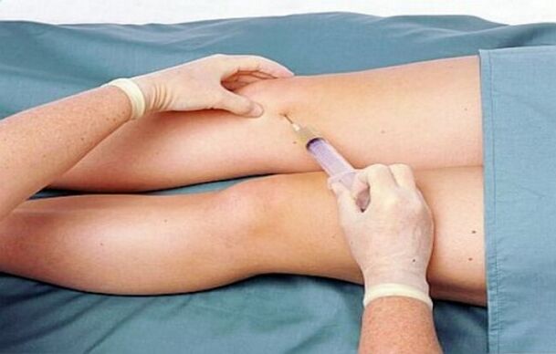 De Grad vun Arthrosis vum Knéi Gelenk