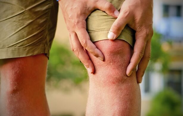 Klinesch Bild vun Arthrosis