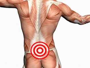 Osteochondrose vun der Lendegéigend