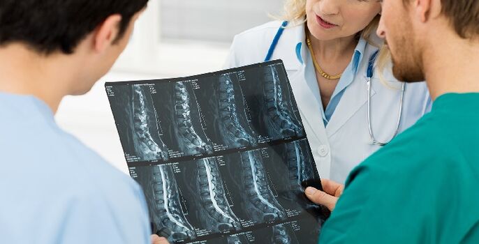 Röntgen vun der Wirbelsäule als e Wee fir Osteochondrose ze diagnostéieren