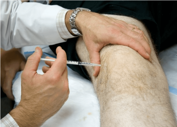 Intra -articular Administratioun vun der Analgetiker a schwéiere Péng